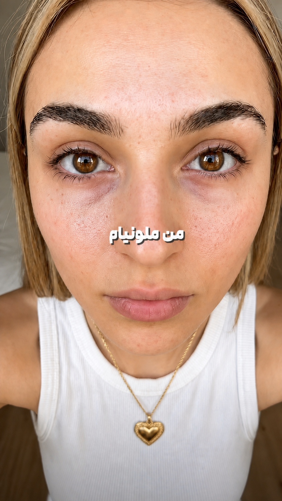 ملونیا / نمای نزدیک